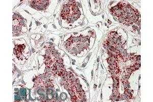 Immunohistochemistry (IHC) image for anti-Aconitase 2, Mitochondrial (ACO2) (AA 541-555) antibody (ABIN571125)