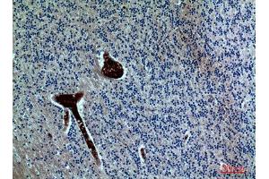 Immunohistochemistry (IHC) analysis of paraffin-embedded Human Brain, antibody was diluted at 1:100. (FGF17 抗体  (Internal Region))