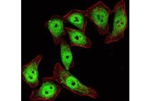 Immunofluorescence analysis of ECA109 cells using KLF4 mouse mAb (green).