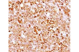 IHC testing of human tonsil (20X) stained with CD79a antibody cocktail (JCB117 + HM47/A9). (CD79a 抗体  (AA 202-216))