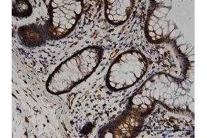 Immunoperoxidase of monoclonal antibody to TRAM2 on formalin-fixed paraffin-embedded human colon. (TRAM2 抗体  (AA 310-369))