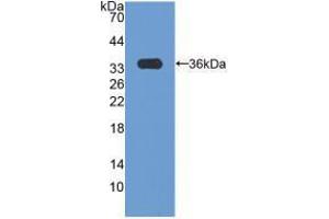 Western blot analysis of recombinant Human CCND3. (Cyclin D3 抗体  (AA 1-292))
