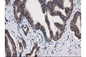 Image no. 4 for anti-Catenin (Cadherin-Associated Protein), beta 1, 88kDa (CTNNB1) antibody (ABIN1496890) (CTNNB1 抗体)