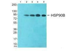 Western blot analysis of extracts from HeLa cells (Lane 2), CoLo cells (Lane 3), HepG2 cells (Lane 4) and 293 cells (Lane 5), using HSP90B (Ab-254) antiobdy. (HSP9AB1 (Ser254) 抗体)