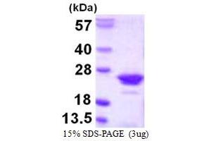 Regulator of G-Protein Signaling 10 (RGS10) (AA 1-181) protein (His tag)