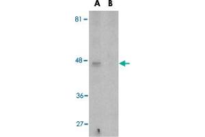 Western blot analysis of APOBEC3G expression in Caco-2 cell lysate in the (A), absence and (B) presence of blocking peptide with APOBEC3G polyclonal antibody  at 5 ug/mL . (APOBEC3G 抗体  (N-Term))