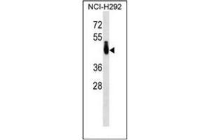 Western blot analysis of PABPC4L Antibody (C-term) in NCI-H292 cell line lysates (35ug/lane). (PABPC4L 抗体  (C-Term))