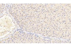 Detection of INSR in Human Liver Tissue using Polyclonal Antibody to Insulin Receptor (INSR)