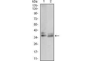 Western Blotting (WB) image for anti-Acid Phosphatase 5, Tartrate Resistant (ACP5) (AA 221-325) antibody (ABIN1724847)