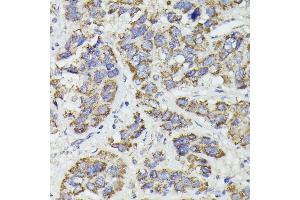 Immunohistochemistry (IHC) image for anti-Succinate-CoA Ligase, GDP-Forming, beta Subunit (SUCLG2) (AA 50-300) antibody (ABIN6148690)