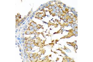 Immunohistochemistry of paraffin-embedded rat testis using  Rabbit mAb (ABIN7265532) at dilution of 1:100 (40x lens). (ALDH1A2 抗体)
