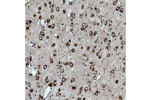 Immunohistochemical analysis of CACNG3 staining in rat brain formalin fixed paraffin embedded tissue section. (CACNG3 抗体)