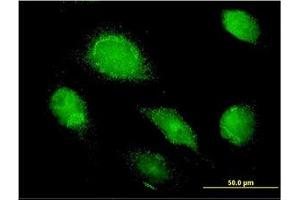 Image no. 1 for anti-alpha 1 Microglobulin/bikunin precursor (AMBP) (AA 19-353) antibody (ABIN598537) (AMBP 抗体  (AA 19-353))