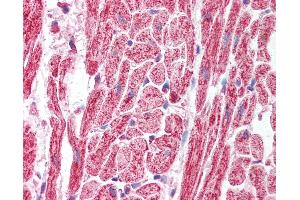 Anti-SAP18 antibody IHC of human heart. (SAP18 抗体  (AA 30-79))