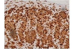 ABIN6256714 and ABIN6267384 at 1/200 staining Rat ganstric tissue sections by IHC-P. (Ezrin 抗体  (pTyr353, pTyr354))