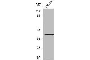 Western Blot analysis of Jurkat cells using PKAα/β cat Polyclonal Antibody (PRKACA/PRKACB 抗体  (N-Term))