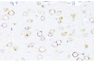 Immunohistochemistry of paraffin-embedded Rat brain using DNAJB11 Polyclonal Antibody at dilution of 1:100 (40x lens). (DNAJB11 抗体)