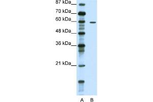 WB Suggested Anti-TRIM62 Antibody Titration:  1. (TRIM62 抗体  (N-Term))