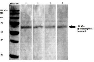 Western Blot analysis of Rat brain lysates showing detection of Synaptotagmin 7 protein using Mouse Anti-Synaptotagmin 7 Monoclonal Antibody, Clone S275-14 . (SYT7 抗体  (AA 150-239) (FITC))