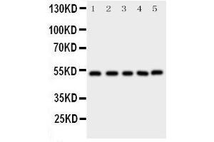 Western Blotting (WB) image for anti-SMAD, Mothers Against DPP Homolog 5 (SMAD5) (AA 248-267), (Middle Region) antibody (ABIN3043980) (SMAD5 抗体  (Middle Region))
