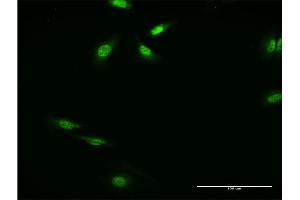 Immunofluorescence (IF) image for anti-Regulatory Factor X-Associated Ankyrin Containing Protein (RFXANK) (AA 1-90) antibody (ABIN522077)