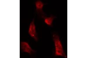 ABIN6267677 staining NIH-3T3 by IF/ICC. (ATRIP 抗体  (pSer68))