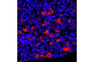 Immunofluorescence of paraffin embedded mouse hypophysis using TSH (ABIN7075906) at dilution of 1:400 (400x lens) (TSHB 抗体)
