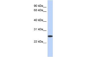 BLVRB antibody used at 1 ug/ml to detect target protein.