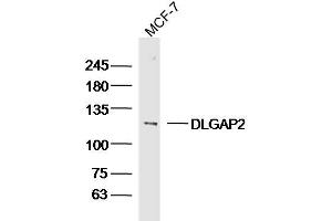 MCF-7 lysates probed with DLGAP2 Polyclonal Antibody, Unconjugated  at 1:300 dilution and 4˚C overnight incubation. (DLGAP2 抗体  (AA 251-360))