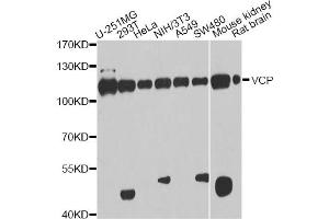 Western blot analysis of extracts of various cell lines, using VCP antibody. (VCP 抗体)
