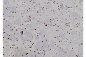 ABIN6266276 and ABIN6277441 at 1/100 staining Rat brain tissue by IHC-P. (SUMO4 抗体  (Internal Region))