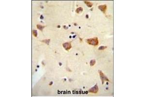 Immunohistochemistry (Paraffin-embedded Sections) (IHC (p)) image for anti-Olfactory Receptor, Family 2, Subfamily Z, Member 1 (OR2Z1) (AA 68-96), (N-Term) antibody (ABIN655017)