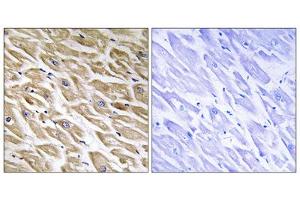 Immunohistochemistry analysis of paraffin-embedded human heart tissue using MRPL39 antibody. (MRPL39 抗体  (C-Term))