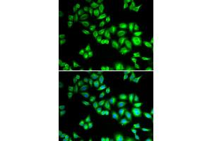 Immunofluorescence analysis of HeLa cells using CUL1 antibody. (Cullin 1 抗体)