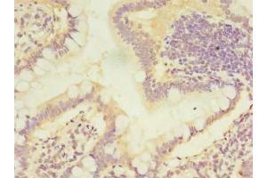 Immunohistochemistry of paraffin-embedded human small intestine tissue using ABIN7146755 at dilution of 1:100 (CMBL 抗体  (AA 2-245))