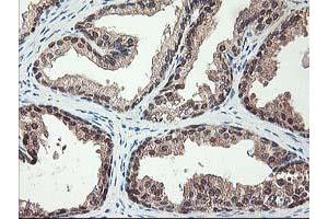Image no. 7 for anti-NIF3 NGG1 Interacting Factor 3-Like 1 (NIF3L1) antibody (ABIN1496618)