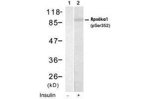 Western blot analysis of extract from HUVEC cells using Rps6ka1 (phospho S352) polyclonal antibody (Cat # PAB12168, Lane 1 and 2). (RPS6KA1 抗体  (pSer352))