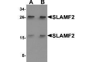 Western blot analysis of SLAMF2 in rat lung tissue lysate with SLAMF2 antibody at (A) 1 and (B) 2 µg/mL.