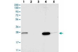 Western blot analysis of Lane 1: RT-4, Lane 2: U-251 MG, Lane 3: Human Plasma, Lane 4: Liver, Lane 5: Tonsil with SIGMAR1 polyclonal antibody . (SIGMAR1 抗体)