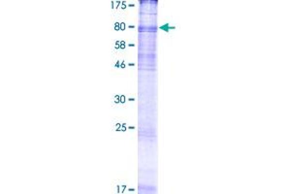 SLC6A8 Protein (AA 1-635) (GST tag)