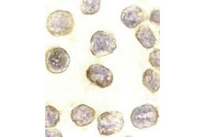 Immunocytochemical staining of DAXX in HeLa cells with DAXX antibody at 10μg/ml. (DAXX 抗体)
