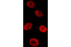 ABIN6267658 staining HepG2 by IF/ICC. (SMAD2 抗体  (pSer467))