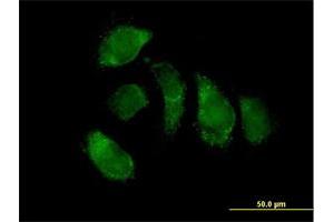 Immunofluorescence of purified MaxPab antibody to EHHADH on HeLa cell. (EHHADH 抗体  (AA 1-723))