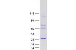 Western Blotting (WB) image for Achaete-Scute Complex Homolog 3 (ASCL3) protein (Myc-DYKDDDDK Tag) (ABIN2714976)