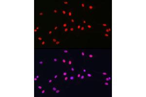 Immunofluorescence (IF) image for anti-SRY (Sex Determining Region Y)-Box 10 (SOX10) (AA 200-300) antibody (ABIN7270568)