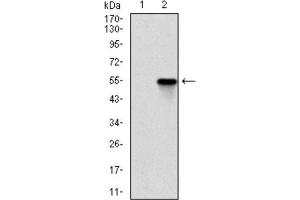 Western Blotting (WB) image for anti-rho-Associated, Coiled-Coil Containing Protein Kinase 1 (ROCK1) antibody (ABIN1846125) (ROCK1 抗体)