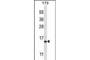 NR2C2 Antibody (N-term) 12673a western blot analysis in Y79 cell line lysates (35 μg/lane). (NR2C2AP 抗体  (N-Term))