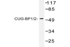 Western blot (WB) analysis of CUG-BP1/2 antibody in extracts from HeLa cells.