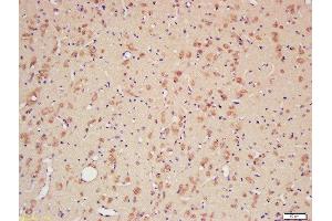 Formalin-fixed and paraffin embedded rat brain labeled with Rabbit Anti-CYPA Polyclonal Antibody, Unconjugated (ABIN759716) at 1:200 followed by conjugation to the secondary antibody and DAB staining (PPIA 抗体  (AA 101-165))