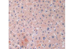 IHC-P analysis of liver tissue, with DAB staining. (RNASE13 抗体  (AA 20-156))